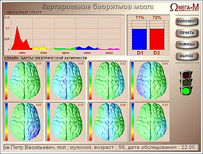 Картирование биоритмов мозга - оценка психоэмоционального состояния 